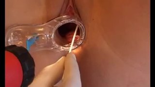 Medical bdsm and extreme doctors fetish of crying amateur ...